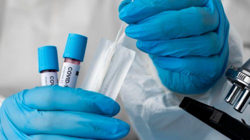[Estudo indica que pacientes com deficiência de vitamina D têm maior chance de desenvolver form...]