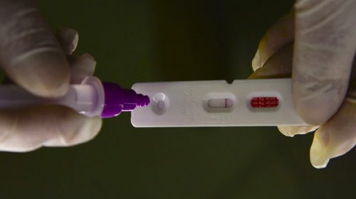 [Pesquisadores identificam método capaz de prever gravidade da Covid-19]
