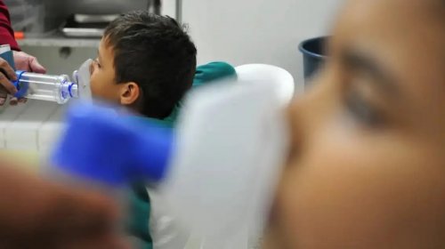 [Governo Federal destina R$ 100 milhões ao SUS para tratar crianças com Síndrome Respiratória Aguda Grave]