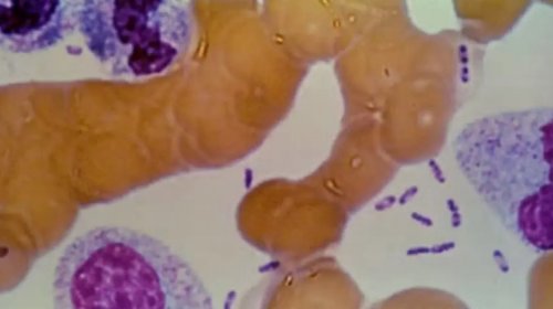 [Cientistas identificam bactéria responsável pela primeira pandemia mundial]