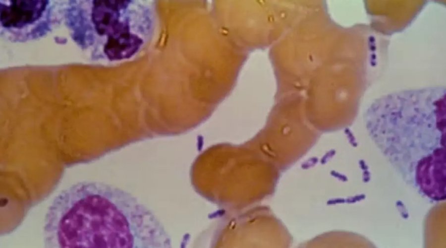 [Cientistas identificam bactéria responsável pela primeira pandemia mundial]