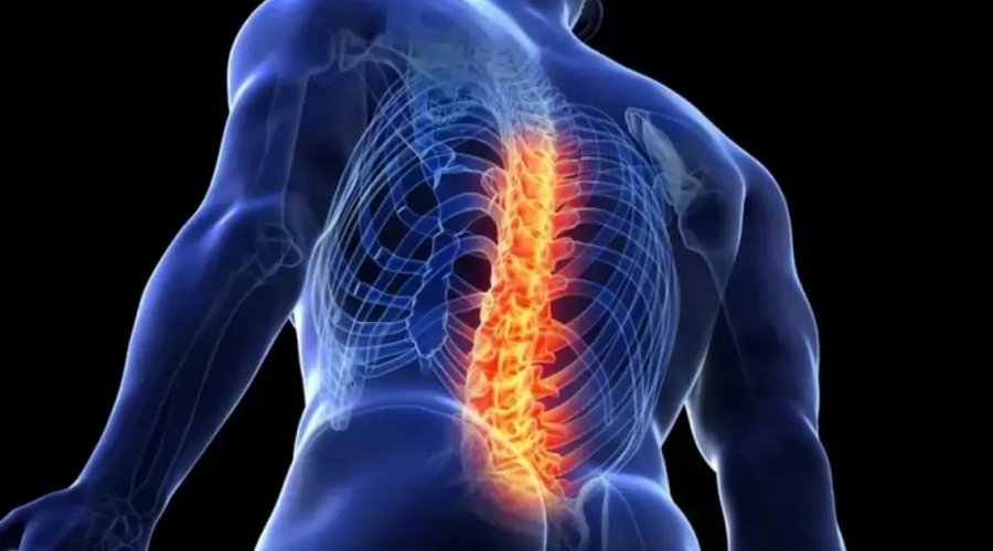 [Dor nas costas afeta mais de 600 milhões de pessoas no mundo; especialistas indicam nova abordagem para o tratamento]