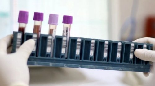 [Bahia passa a contar com pontos de coleta para exame genético de alta complexidade no SUS]