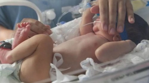 [Vacinação de gestantes reduz casos graves de bronquiolite em bebês, aponta levantamento]
